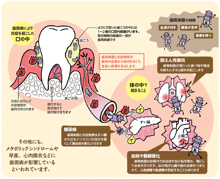 歯周病予防で歯もカラダも健康に！