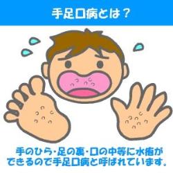 イラスト：手足口病